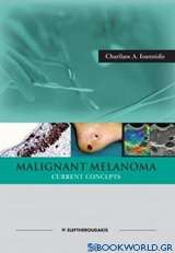 Malignant Melanoma Current Concepts