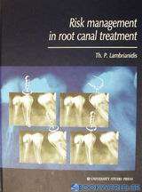 Risk Management in Root Canal Treatment