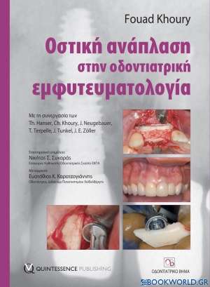 Οστική ανάπλαση στην οδοντιατρική εμφυτευματολογία